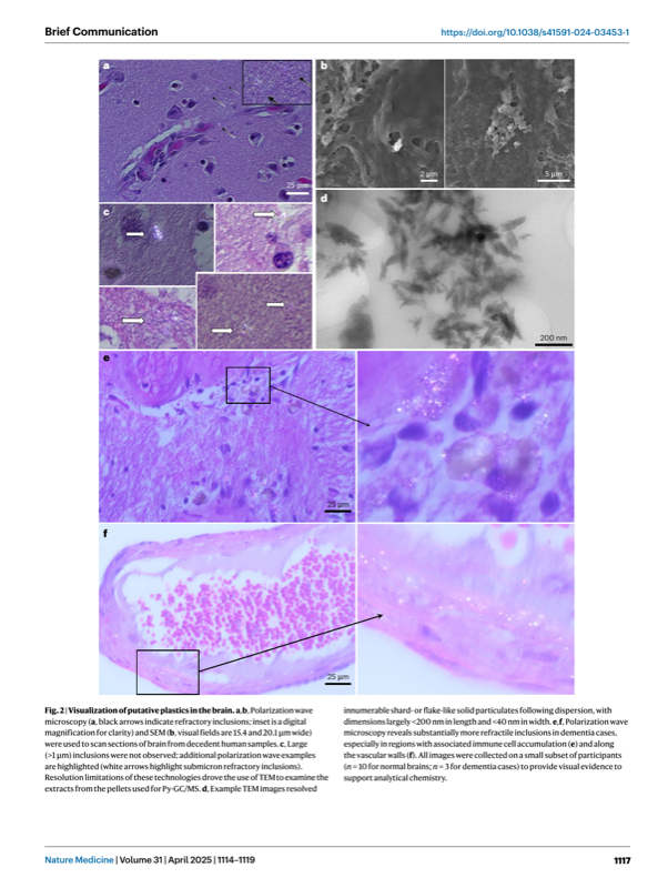 SEM of nanoplastics in brain tissue